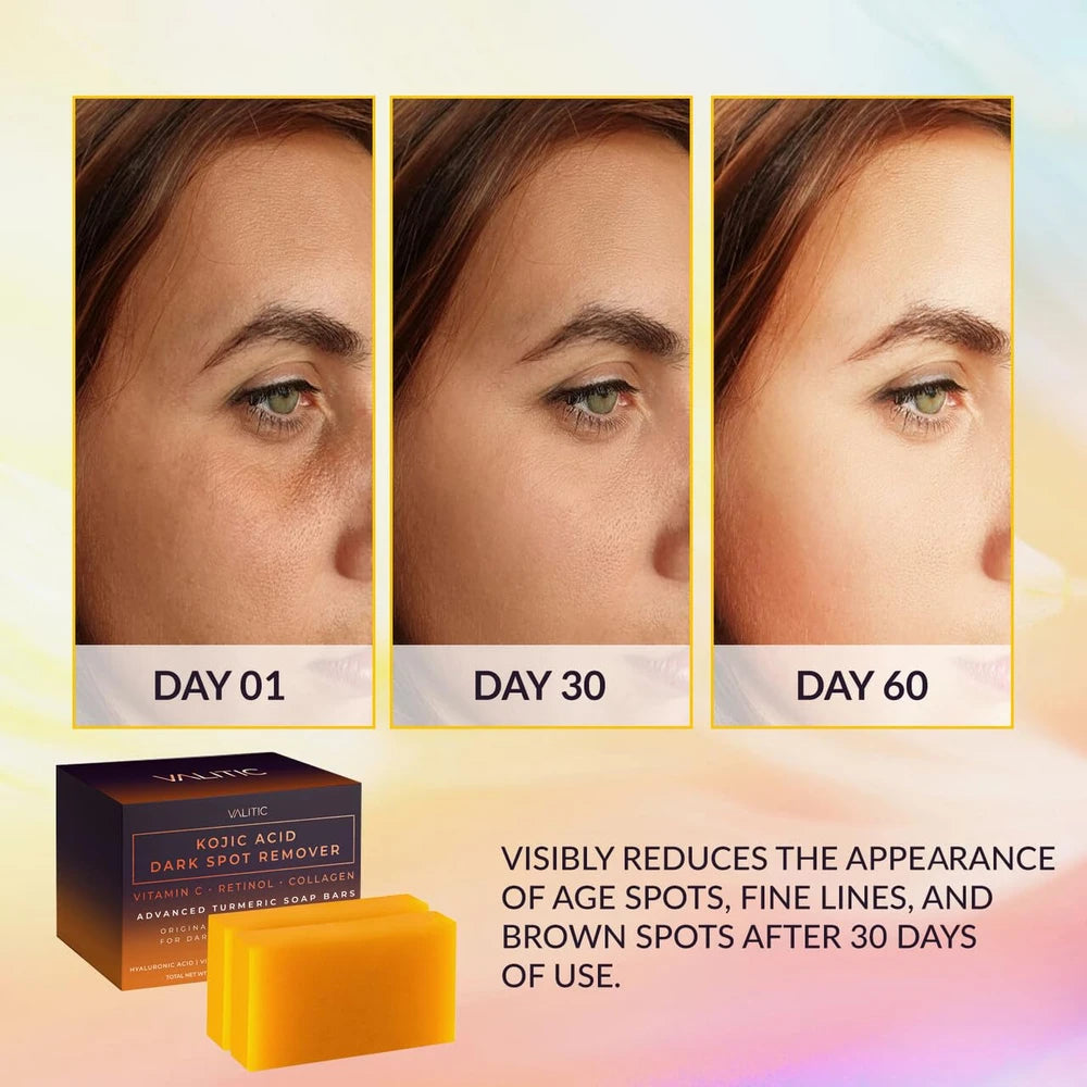 Valitic Turmeric Dark Spot Soap